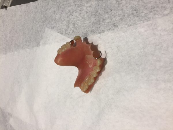 Library Dentures